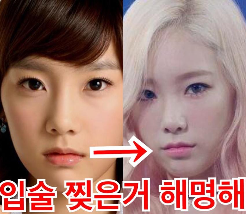 “이게 그 얼굴 맞아요?”…과한 볼륨 시술로 얼굴 망친 연예인들 진짜 이유
